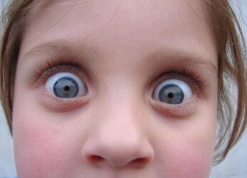 Embrace the unexpected